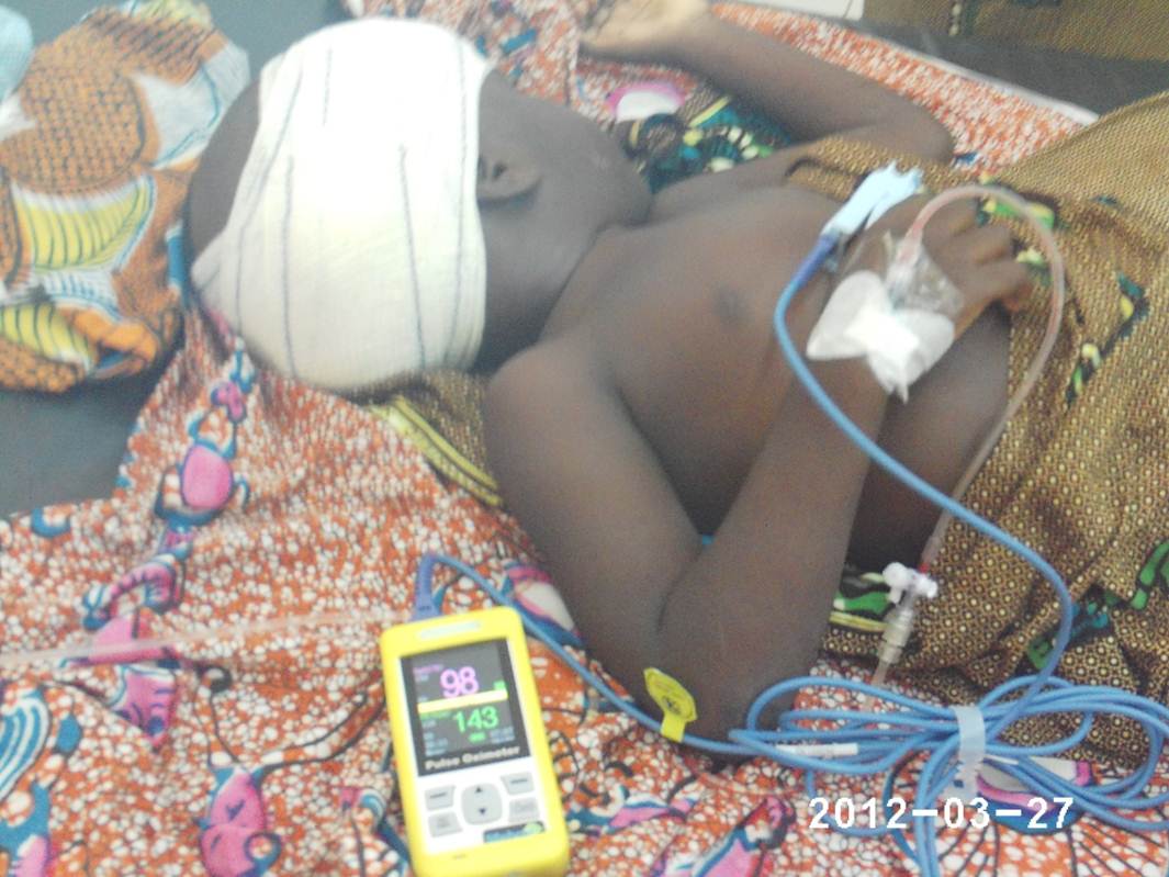 Oximetry patient_Lome_Togo_2012